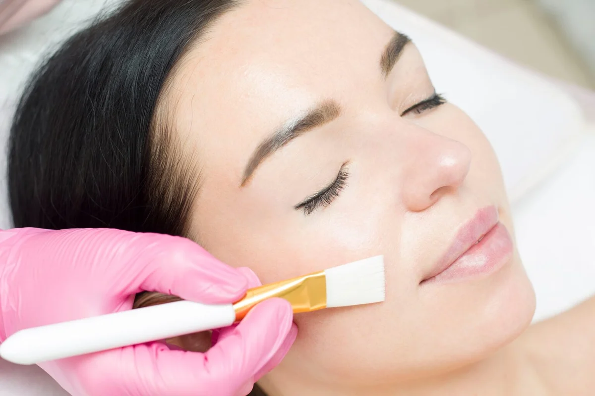 Applying Chemical Peel