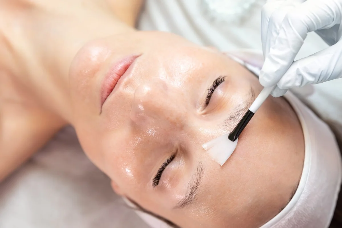 Chemical Peel Treatment Process